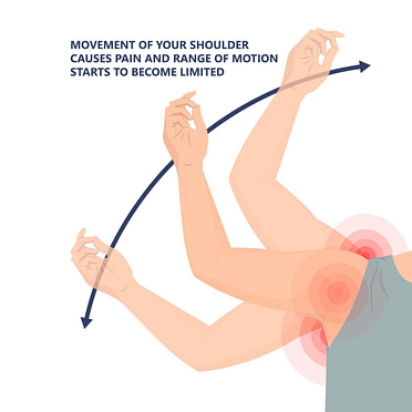 Rotator Cuff Range of Motion Rotator Cuff Range of Motion | Fighting Arts Health Lab