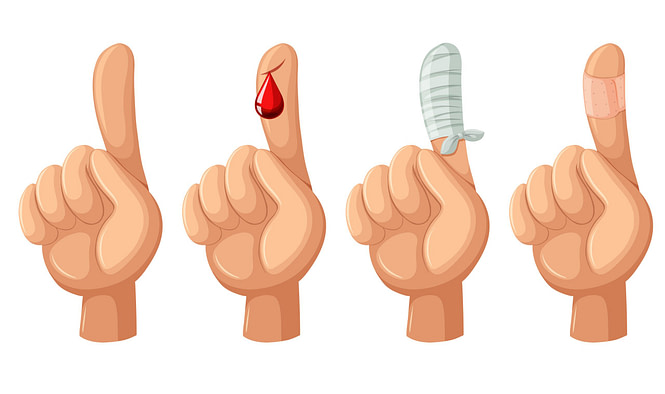 Combat Arts Finger Injuries Symptoms |Fighting Arts Health Lab Combat Arts Finger Injuries Symptoms