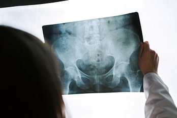 Hips HCP XRay Assesss Hip Injury Diagnosis | Fighting Arts Health Lab