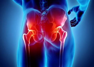 Pain in the hips Pain in the hips