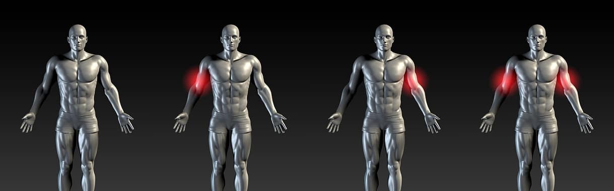 Bicep Injury Illustration Bicep Injury Illustration | Fighting Arts Health Lab