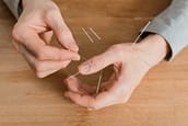 Combat Arts Finger Injuries Treatment Acupuncture Combat Arts Finger Injuries Treatment Acupuncture | Fighting Arts Health lab