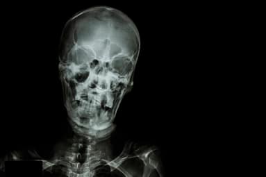 Head Injury XRay Head Injury XRay | Fighting Arts Health Lab