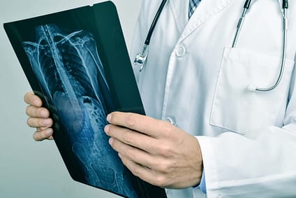 Spine HCP Assess XRay Spine Injury XRay | Fighting Arts Health Lab