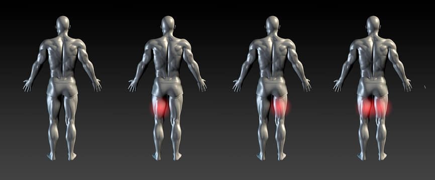 Hamstring Injury Overview | Fighting Arts Health Lab