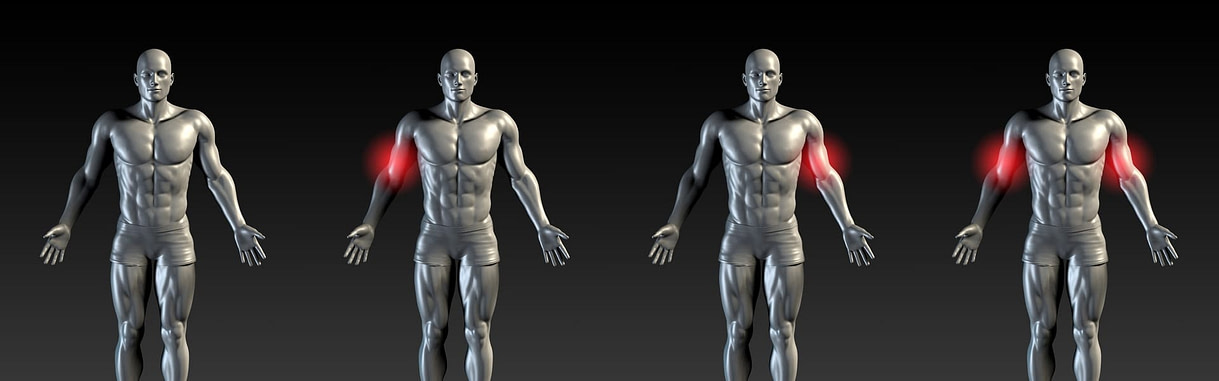 Bicep Injury Illustration Bicep Injury Illustration | Fighting Arts Health Lab