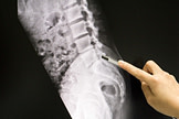 Lower Back Injury Diagnosis Lower Back Injury Diagnosis | Fighting Arts Health Lab