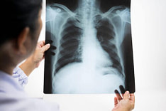 Rib Injury Diagnosis Rib Injury Diagnosis