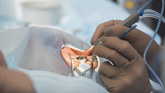 Eye Surgery Eye Surgery | Fighting Arts Health Lab