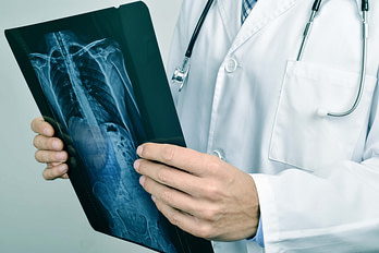 Spine HCP Assess XRay Spine Injury XRay | Fighting Arts Health Lab