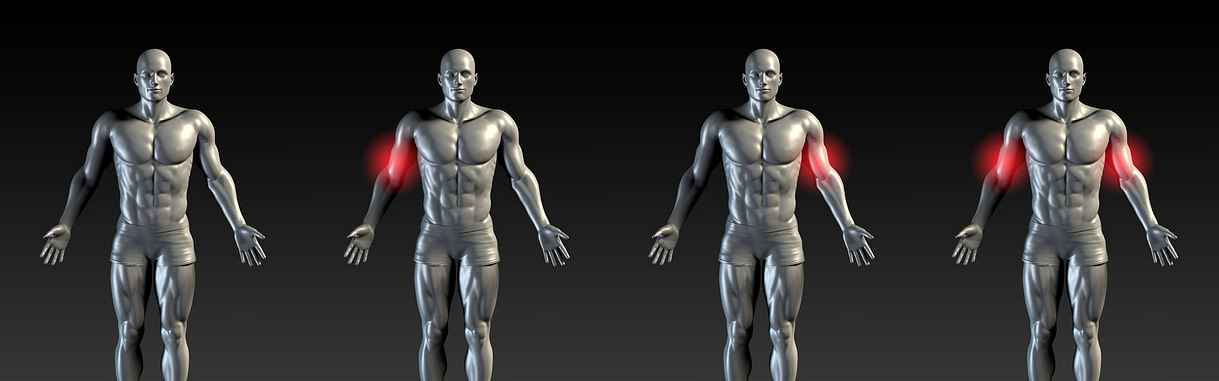 Bicep Injury Illustration Bicep Injury Illustration | Fighting Arts Health Lab