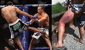 Jose Aldo Faber Leg Kicks Jose Aldo Faber Leg Kicks | Fighting Arts Health Lab