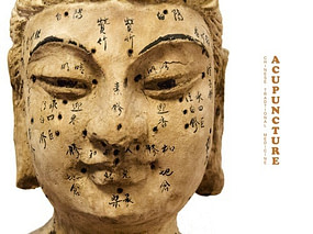 Acupuncture Pain Management | Fighting Arts Health Lab Acupuncture Pain Management | Fighting Arts Health Lab