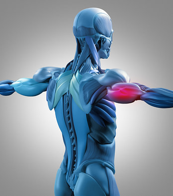 Tricep Model Pain Illustration Tricep Model Pain Illustration | Fighting Arts Health Lab