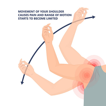 Rotator Cuff Range of Motion | Fighting Arts Health Lab