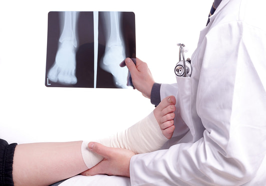 Combat Arts Ankle Injuries XRay Diagnosis Combat Arts Ankle Injuries Diagnosis | Fighting Arts Health Lab